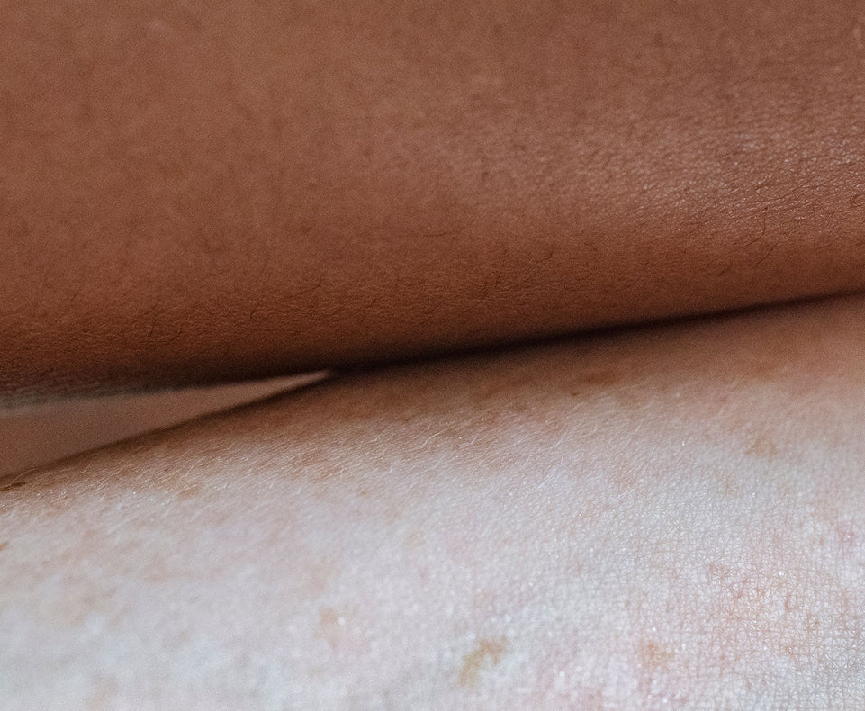 How do I know my skin type?