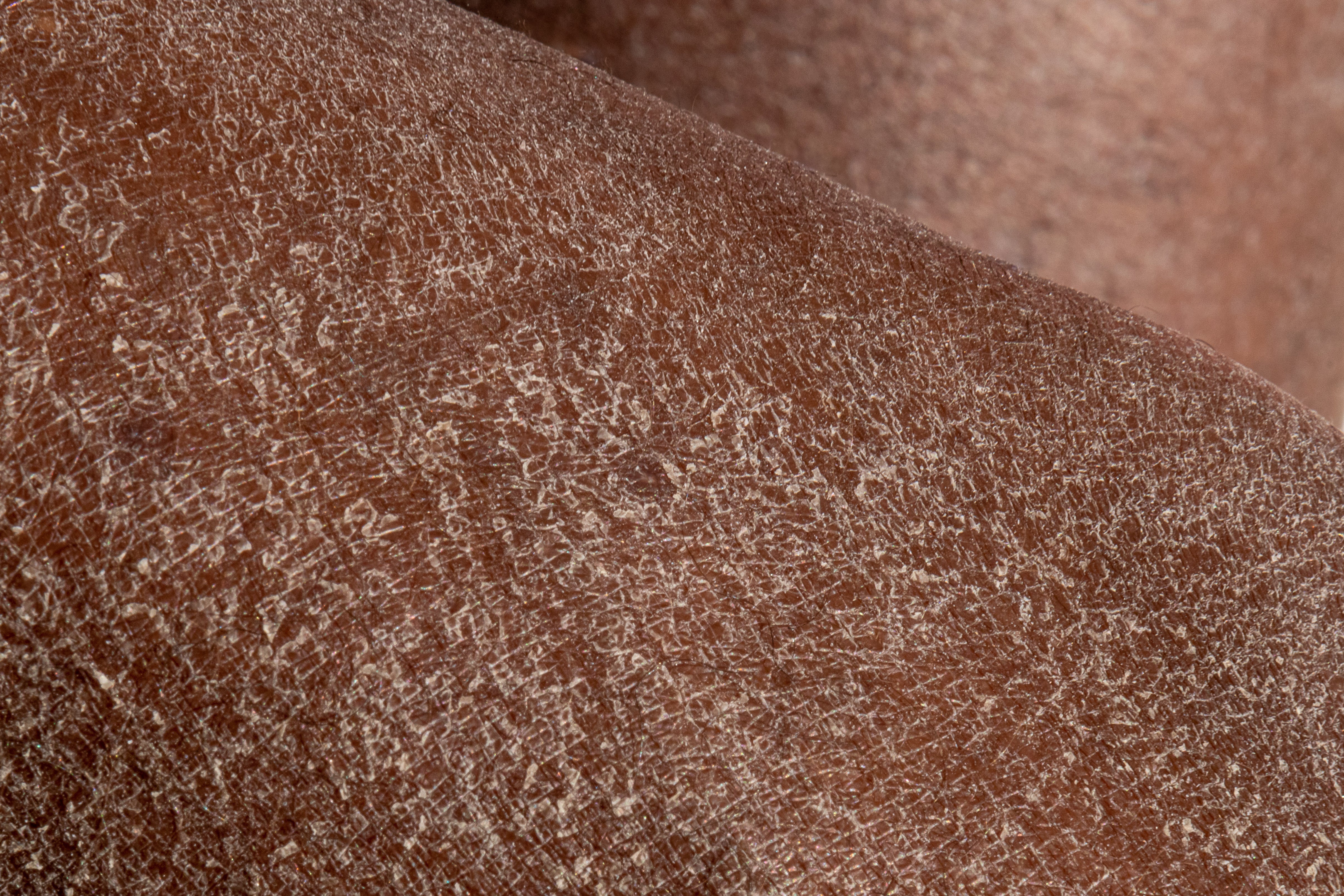 Why Is My Skin So Dry Even When I Moisturise?