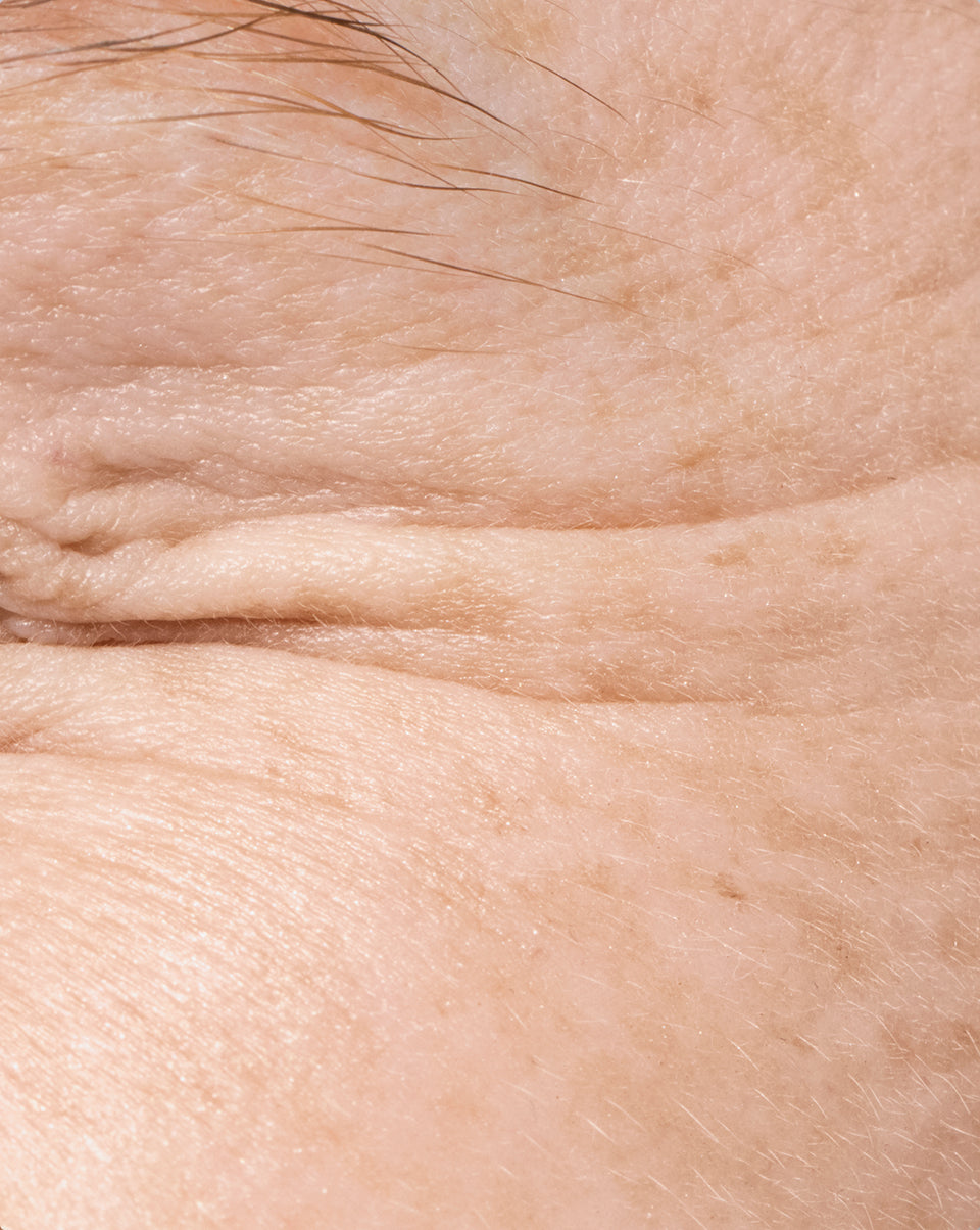 Ageing & Firmness, Fine Lines & Wrinkles